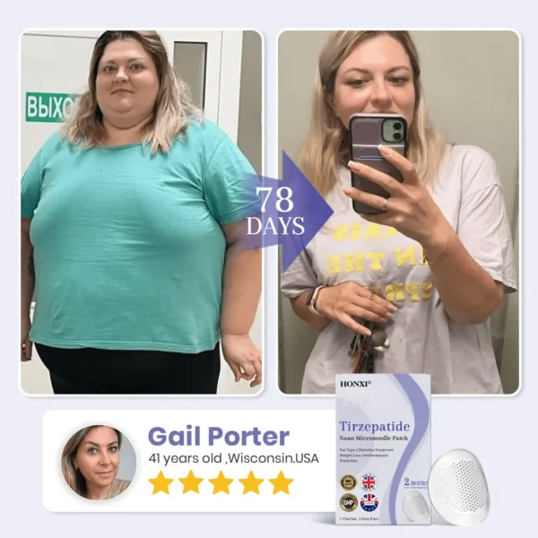 𝗛𝗼𝗻𝘅𝗶® 𝗡𝗜𝗗𝗗𝗞-𝗧𝗶𝗿𝘇𝗲𝗽𝗮𝘁𝗶𝗱𝗲 𝗡𝗮𝗻𝗼 𝗠𝗶𝗰𝗿𝗼𝗻𝗲𝗲𝗱𝗹𝗲 𝗣𝗮𝘁𝗰𝗵
