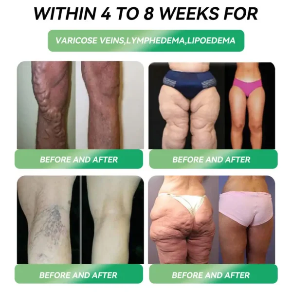 🇺🇸𝑶𝒇𝒇𝒊𝒄𝒊𝒂𝒍 𝑺𝒕𝒐𝒓𝒆|𝐇𝐨𝐧𝐱𝐢® 𝐍𝐀𝐃+ 𝐆𝐋𝐏-𝟏 𝐒𝐢𝐱 𝐢𝐧 𝐎𝐧𝐞 𝐇𝐞𝐚𝐥𝐭𝐡 𝐒𝐨𝐥𝐮𝐭𝐢𝐨𝐧 𝐎𝐫𝐚𝐥 𝐋𝐢𝐪𝐮𝐢𝐝 (𝐉𝐮𝐬𝐭 𝐨𝐧𝐜𝐞 𝐚 𝐝𝐚𝐲, 𝐯𝐢𝐬𝐢𝐛𝐥𝐞 𝐜𝐡𝐚𝐧𝐠𝐞𝐬 𝐢𝐧 𝟕 𝐝𝐚𝐲𝐬） ✅ 𝐅𝐨𝐫 𝐨𝐛𝐞𝐬𝐢𝐭𝐲, 𝐜𝐚𝐫𝐝𝐢𝐨𝐯𝐚𝐬𝐜𝐮𝐥𝐚𝐫 𝐡𝐞𝐚𝐥𝐭𝐡, 𝐝𝐢𝐚𝐛𝐞𝐭𝐞𝐬, 𝐬𝐥𝐞𝐞𝐩 𝐚𝐩𝐧𝐞𝐚, 𝐆𝐮𝐭 𝐇𝐞𝐚𝐥𝐭𝐡, 𝐣𝐨𝐢𝐧𝐭 𝐢𝐬𝐬𝐮𝐞𝐬, 𝐚𝐧𝐝 𝐦𝐨𝐫𝐞