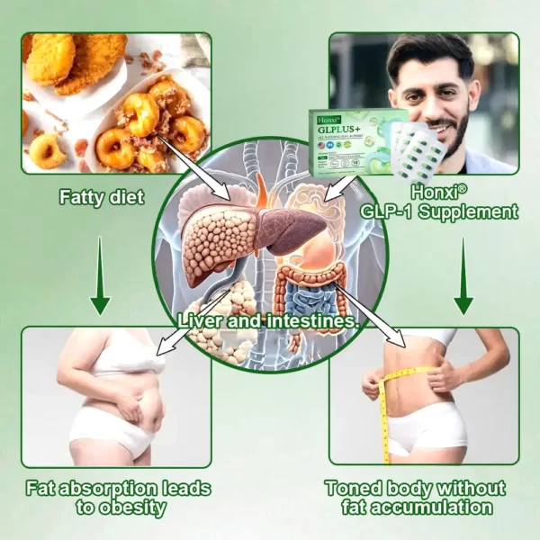 Honxi® Glplus+ All Natural Glp-1 Support🌿NAD+ & Moringa & ACV & Keto BHB (✅speedy, long-lasting, addressing diabetes, obesity, and cardiovascular diseases) ✅