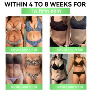 ๐ฏ๐๐๐๐ยฎ โกโก๐บ๐ฎ๐ณ๐ป-๐๐ + ๐ฎ๐ณ๐ท-๐ ๐ฆ๐น๐ถ๐บ & ๐ฏ๐๐๐๐๐ ๐ถ๐๐๐ ๐บ๐๐๐๐๐๐๐ (๐๐๐๐ ๐ ๐๐๐ฆ, ๐ฃ๐๐ ๐๐๐๐ ๐๐๐ ๐ข๐๐ก๐ ๐๐ 7 ๐๐๐ฆ๐ ) โ
๐ฆ๐๐ฝ๐ฝ๐ผ๐ฟ๐๐ ๐ผ๐ฏ๐ฒ๐๐ถ๐๐, ๐ฐ๐ฎ๐ฟ๐ฑ๐ถ๐ผ๐๐ฎ๐๐ฐ๐๐น๐ฎ๐ฟ ๐ต๐ฒ๐ฎ๐น๐๐ต, ๐ฑ๐ถ๐ฎ๐ฏ๐ฒ๐๐ฒ๐, ๐๐น๐ฒ๐ฒ๐ฝ ๐ฎ๐ฝ๐ป๐ฒ๐ฎ, ๐ด๐๐ ๐ต๐ฒ๐ฎ๐น๐๐ต, ๐ท๐ผ๐ถ๐ป๐ ๐ถ๐๐๐๐ฒ๐, ๐ฐ๐ก๐ข๐ฅ๐ ๐๐ฅ๐ฌ๐จ ๐๐ข๐ซ๐ฆ๐ข๐ง๐ ๐ญ๐ก๐ ๐ฌ๐ค๐ข๐ง ๐๐ง๐ ๐๐จ๐จ๐ฌ๐ญ๐ข๐ง๐ ๐๐ง๐๐ซ๐ ๐ฒ