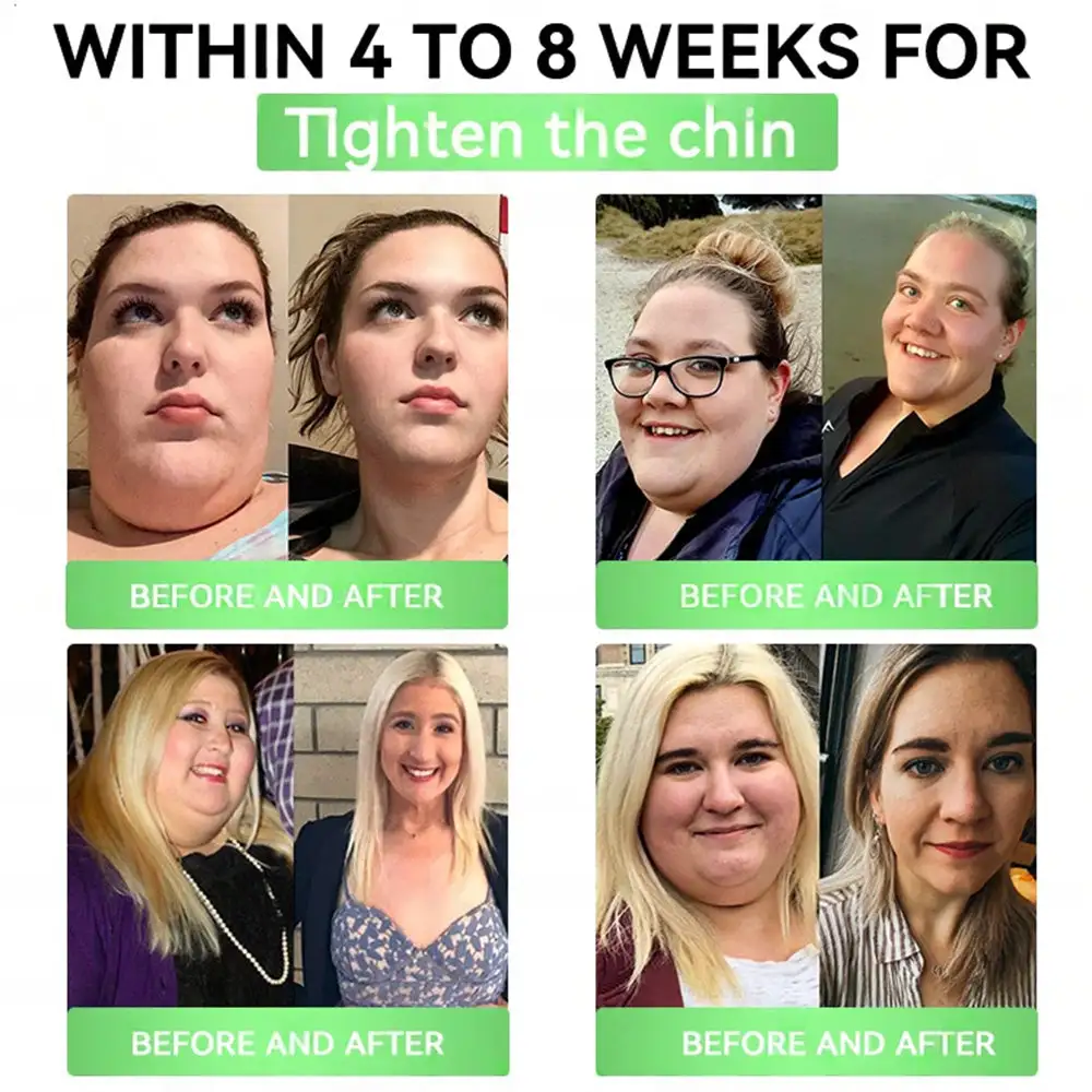 ๐ถ๐๐๐๐๐๐๐ ๐บ๐๐๐๐ | ๐ฏ๐๐๐๐ยฎ๐จโโ๏ธ๐ฎ๐ณ๐ท-๐+๐บ๐ฎ๐ณ๐ป-๐๐ ๐ฆ๐น๐ถ๐บ & ๐ฏ๐๐๐๐๐ ๐ถ๐๐๐ ๐บ๐๐๐๐๐๐๐ (๐๐๐๐ ๐ ๐๐๐ฆ, ๐ฃ๐๐ ๐๐๐๐ ๐๐๐ ๐ข๐๐ก๐ ๐๐ 7 ๐๐๐ฆ๐ ) โ
๐ฆ๐๐ฝ๐ฝ๐ผ๐ฟ๐๐ ๐ผ๐ฏ๐ฒ๐๐ถ๐๐, ๐ฐ๐ฎ๐ฟ๐ฑ๐ถ๐ผ๐๐ฎ๐๐ฐ๐๐น๐ฎ๐ฟ ๐ต๐ฒ๐ฎ๐น๐๐ต, ๐ฑ๐ถ๐ฎ๐ฏ๐ฒ๐๐ฒ๐, ๐๐น๐ฒ๐ฒ๐ฝ ๐ฎ๐ฝ๐ป๐ฒ๐ฎ, ๐ด๐๐ ๐ต๐ฒ๐ฎ๐น๐๐ต, ๐ท๐ผ๐ถ๐ป๐ ๐ถ๐๐๐๐ฒ๐, ๐ฐ๐ก๐ข๐ฅ๐ ๐๐ฅ๐ฌ๐จ ๐๐ข๐ซ๐ฆ๐ข๐ง๐ ๐ญ๐ก๐ ๐ฌ๐ค๐ข๐ง ๐๐ง๐ ๐๐จ๐จ๐ฌ๐ญ๐ข๐ง๐ ๐๐ง๐๐ซ๐ ๐ฒ