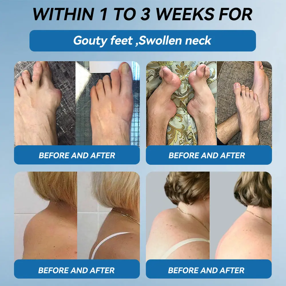 HONXI® BPC-157 Joint Healing Cream🦴Treats Arthritis, Neuropathy, Rheumatism, Sports Injuries & More 🌹