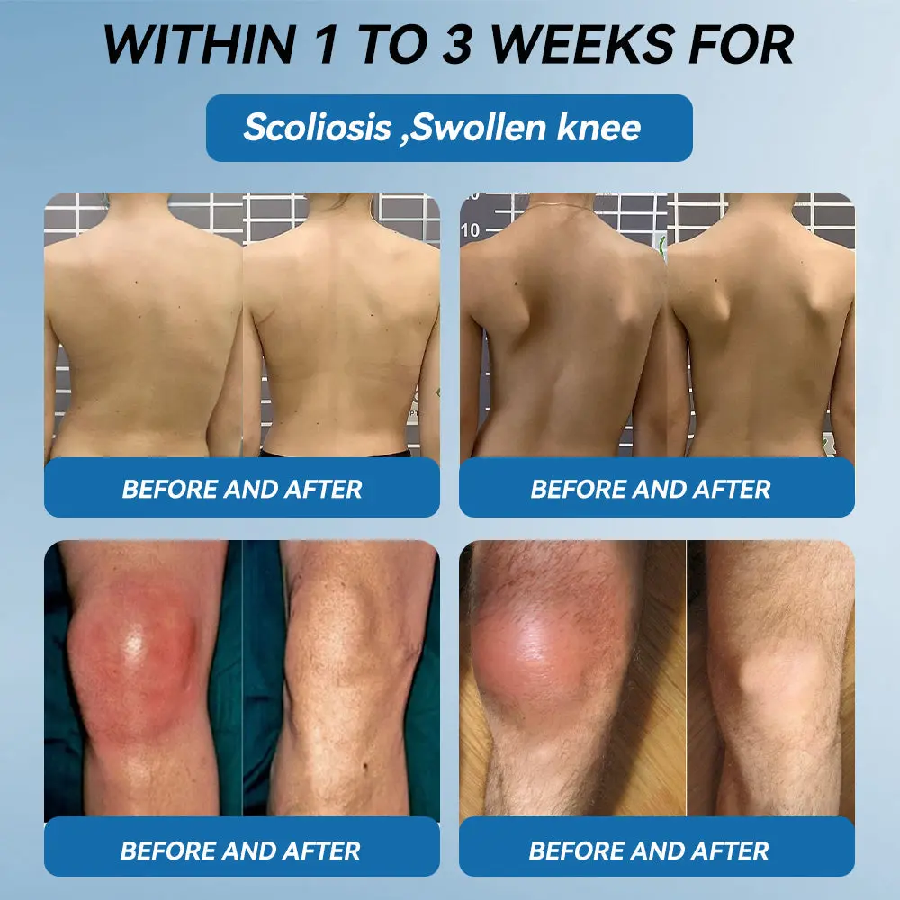 HONXI® BPC-157 Joint Healing Cream🦴Treats Arthritis, Neuropathy, Rheumatism, Sports Injuries & More 🌹