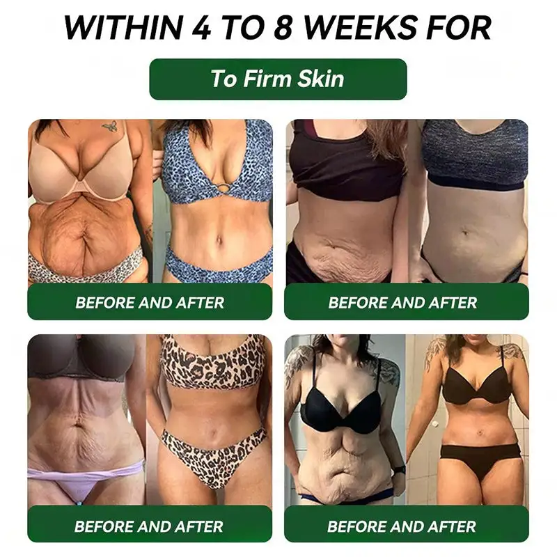 ๐บ๐ธUS Official Store | HONXIยฎ NAD+ GLP-1 9-in-1 Health Oral Liquid(๐ง๐ต๐ฒ ๐ฃ๐ฒ๐ฟ๐ณ๐ฒ๐ฐ๐ ๐๐ป๐ท๐ฒ๐ฐ๐๐ถ๐ผ๐ป ๐๐น๐๐ฒ๐ฟ๐ป๐ฎ๐๐ถ๐๐ฒ โ ๐ช๐ถ๐๐ต ๐ก๐ผ ๐ฆ๐ถ๐ฑ๐ฒ ๐๐ณ๐ณ๐ฒ๐ฐ๐๐๏ผ โ
๐
๐จ๐ซ ๐จ๐๐๐ฌ๐ข๐ญ๐ฒ, ๐๐๐ซ๐๐ข๐จ๐ฏ๐๐ฌ๐๐ฎ๐ฅ๐๐ซ ๐ก๐๐๐ฅ๐ญ๐ก, ๐๐ข๐๐๐๐ญ๐๐ฌ, ๐ฌ๐ฅ๐๐๐ฉ ๐๐ฉ๐ง๐๐, ๐๐ฎ๐ญ ๐๐๐๐ฅ๐ญ๐ก, ๐ฃ๐จ๐ข๐ง๐ญ ๐ข๐ฌ๐ฌ๐ฎ๐๐ฌ, ๐๐ง๐ ๐ฆ๐จ๐ซ๐