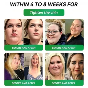 ๐บ๐ธUS Official Store | HONXIยฎ NAD+ GLP-1 9-in-1 Health Oral Liquid(๐ง๐ต๐ฒ ๐ฃ๐ฒ๐ฟ๐ณ๐ฒ๐ฐ๐ ๐๐ป๐ท๐ฒ๐ฐ๐๐ถ๐ผ๐ป ๐๐น๐๐ฒ๐ฟ๐ป๐ฎ๐๐ถ๐๐ฒ โ ๐ช๐ถ๐๐ต ๐ก๐ผ ๐ฆ๐ถ๐ฑ๐ฒ ๐๐ณ๐ณ๐ฒ๐ฐ๐๐๏ผ โ
๐
๐จ๐ซ ๐จ๐๐๐ฌ๐ข๐ญ๐ฒ, ๐๐๐ซ๐๐ข๐จ๐ฏ๐๐ฌ๐๐ฎ๐ฅ๐๐ซ ๐ก๐๐๐ฅ๐ญ๐ก, ๐๐ข๐๐๐๐ญ๐๐ฌ, ๐ฌ๐ฅ๐๐๐ฉ ๐๐ฉ๐ง๐๐, ๐๐ฎ๐ญ ๐๐๐๐ฅ๐ญ๐ก, ๐ฃ๐จ๐ข๐ง๐ญ ๐ข๐ฌ๐ฌ๐ฎ๐๐ฌ, ๐๐ง๐ ๐ฆ๐จ๐ซ๐