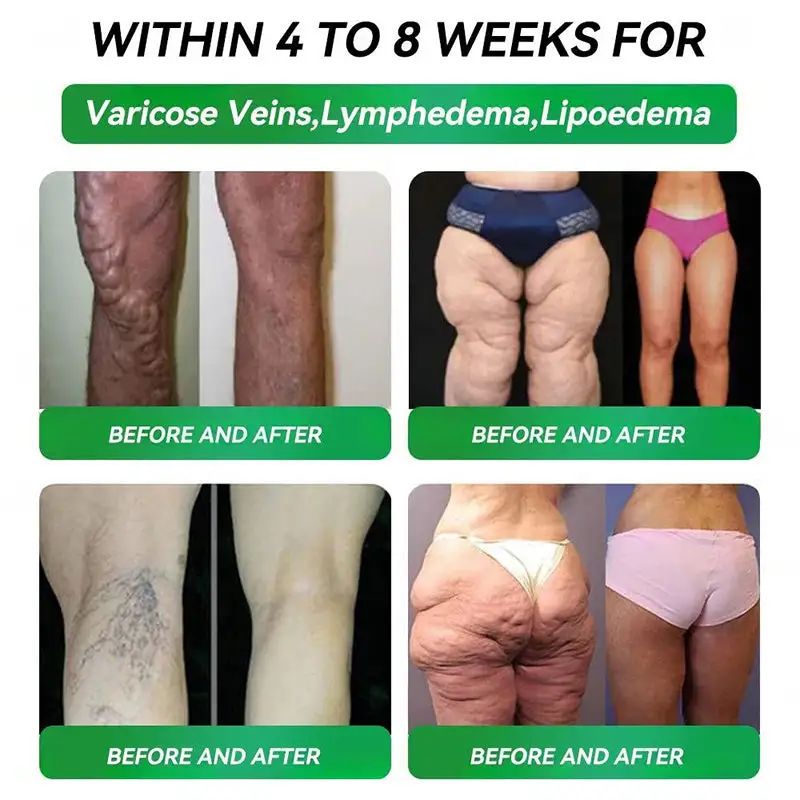 ๐บ๐ธUS Official Store | HONXIยฎ NAD+ GLP-1 9-in-1 Health Oral Liquid(๐ง๐ต๐ฒ ๐ฃ๐ฒ๐ฟ๐ณ๐ฒ๐ฐ๐ ๐๐ป๐ท๐ฒ๐ฐ๐๐ถ๐ผ๐ป ๐๐น๐๐ฒ๐ฟ๐ป๐ฎ๐๐ถ๐๐ฒ โ ๐ช๐ถ๐๐ต ๐ก๐ผ ๐ฆ๐ถ๐ฑ๐ฒ ๐๐ณ๐ณ๐ฒ๐ฐ๐๐๏ผ โ
๐
๐จ๐ซ ๐จ๐๐๐ฌ๐ข๐ญ๐ฒ, ๐๐๐ซ๐๐ข๐จ๐ฏ๐๐ฌ๐๐ฎ๐ฅ๐๐ซ ๐ก๐๐๐ฅ๐ญ๐ก, ๐๐ข๐๐๐๐ญ๐๐ฌ, ๐ฌ๐ฅ๐๐๐ฉ ๐๐ฉ๐ง๐๐, ๐๐ฎ๐ญ ๐๐๐๐ฅ๐ญ๐ก, ๐ฃ๐จ๐ข๐ง๐ญ ๐ข๐ฌ๐ฌ๐ฎ๐๐ฌ, ๐๐ง๐ ๐ฆ๐จ๐ซ๐