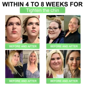 GNC Online | Honxi® 3-in-1(GLP-1+SGLT-2i+NAD⁺/NMN) Slim & Healthy Oral Solution ✅ 𝗦𝘂𝗽𝗽𝗼𝗿𝘁𝘀 𝗼𝗯𝗲𝘀𝗶𝘁𝘆, 𝗰𝗮𝗿𝗱𝗶𝗼𝘃𝗮𝘀𝗰𝘂𝗹𝗮𝗿 𝗵𝗲𝗮𝗹𝘁𝗵, 𝗱𝗶𝗮𝗯𝗲𝘁𝗲𝘀, 𝘀𝗹𝗲𝗲𝗽 𝗮𝗽𝗻𝗲𝗮, 𝗴𝘂𝘁 𝗵𝗲𝗮𝗹𝘁𝗵, 𝗷𝗼𝗶𝗻𝘁 𝗶𝘀𝘀𝘂𝗲𝘀, 𝐰𝐡𝐢𝐥𝐞 𝐚𝐥𝐬𝐨 𝐟𝐢𝐫𝐦𝐢𝐧𝐠 𝐭𝐡𝐞 𝐬𝐤𝐢𝐧 𝐚𝐧𝐝 𝐛𝐨𝐨𝐬𝐭𝐢𝐧𝐠 𝐞𝐧𝐞𝐫𝐠𝐲.