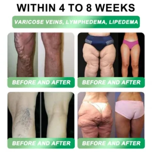 GNC Online | Honxi® 3-in-1(GLP-1+SGLT-2i+NAD⁺/NMN) Slim & Healthy Oral Solution ✅ 𝗦𝘂𝗽𝗽𝗼𝗿𝘁𝘀 𝗼𝗯𝗲𝘀𝗶𝘁𝘆, 𝗰𝗮𝗿𝗱𝗶𝗼𝘃𝗮𝘀𝗰𝘂𝗹𝗮𝗿 𝗵𝗲𝗮𝗹𝘁𝗵, 𝗱𝗶𝗮𝗯𝗲𝘁𝗲𝘀, 𝘀𝗹𝗲𝗲𝗽 𝗮𝗽𝗻𝗲𝗮, 𝗴𝘂𝘁 𝗵𝗲𝗮𝗹𝘁𝗵, 𝗷𝗼𝗶𝗻𝘁 𝗶𝘀𝘀𝘂𝗲𝘀, 𝐰𝐡𝐢𝐥𝐞 𝐚𝐥𝐬𝐨 𝐟𝐢𝐫𝐦𝐢𝐧𝐠 𝐭𝐡𝐞 𝐬𝐤𝐢𝐧 𝐚𝐧𝐝 𝐛𝐨𝐨𝐬𝐭𝐢𝐧𝐠 𝐞𝐧𝐞𝐫𝐠𝐲.