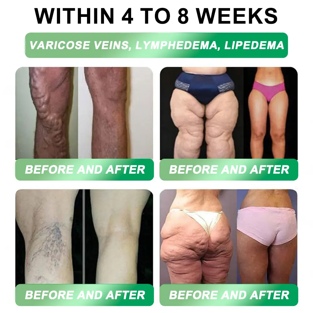 GNC Online | Honxi® 3-in-1(GLP-1+SGLT-2i+NAD⁺/NMN) Slim & Healthy Oral Solution ✅ 𝗦𝘂𝗽𝗽𝗼𝗿𝘁𝘀 𝗼𝗯𝗲𝘀𝗶𝘁𝘆, 𝗰𝗮𝗿𝗱𝗶𝗼𝘃𝗮𝘀𝗰𝘂𝗹𝗮𝗿 𝗵𝗲𝗮𝗹𝘁𝗵, 𝗱𝗶𝗮𝗯𝗲𝘁𝗲𝘀, 𝘀𝗹𝗲𝗲𝗽 𝗮𝗽𝗻𝗲𝗮, 𝗴𝘂𝘁 𝗵𝗲𝗮𝗹𝘁𝗵, 𝗷𝗼𝗶𝗻𝘁 𝗶𝘀𝘀𝘂𝗲𝘀, 𝐰𝐡𝐢𝐥𝐞 𝐚𝐥𝐬𝐨 𝐟𝐢𝐫𝐦𝐢𝐧𝐠 𝐭𝐡𝐞 𝐬𝐤𝐢𝐧 𝐚𝐧𝐝 𝐛𝐨𝐨𝐬𝐭𝐢𝐧𝐠 𝐞𝐧𝐞𝐫𝐠𝐲.