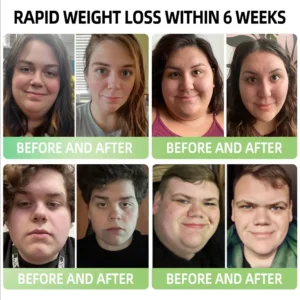 Honxi® 👩‍⚕️SLIM-1 Moringa Slimming & Health Drops( Food-grade fat burner – Developed by The Obesity Society)